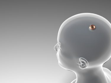 Neuralink abre recrutamento para implantar chips em cérebros humanos